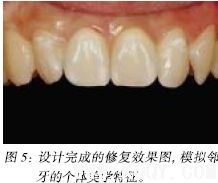 牙齿美学修复中的医技沟通和医患沟通