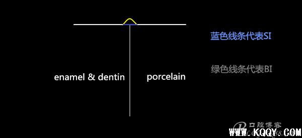 牙科修复中的微创与美学