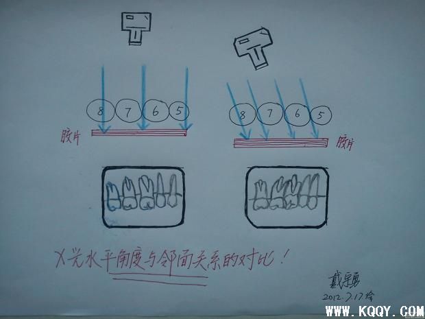 实用牙科X光拍摄技术与心得--戴宇勇