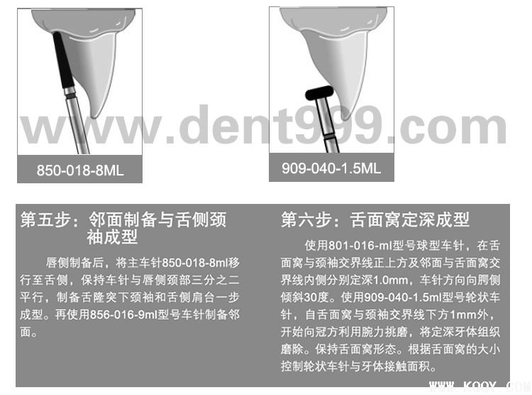 周锐前后牙备牙简明教程