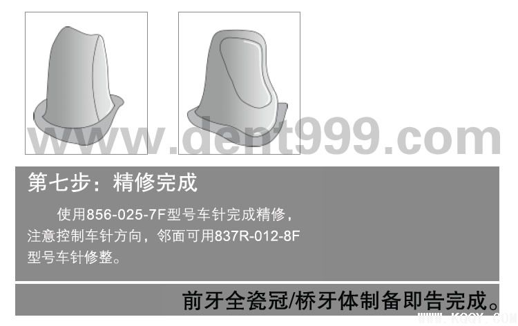 周锐前后牙备牙简明教程