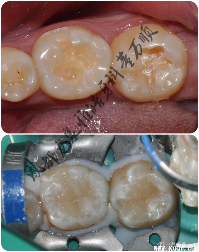 关于器械设备至——所有的基层牙医