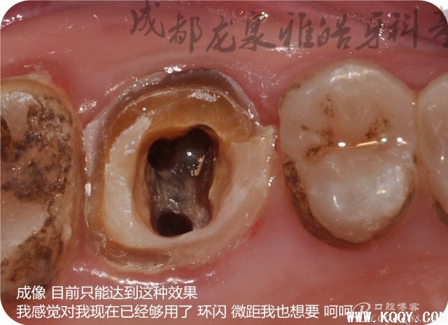 关于器械设备至——所有的基层牙医