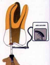 LightSpeed 根管预备技术