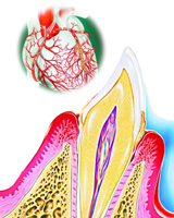 牙周病是冠状动脉疾病的重要危险因素