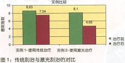 牙周炎传统治疗与激光治疗的比较研究