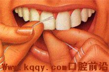 牙线使用方法